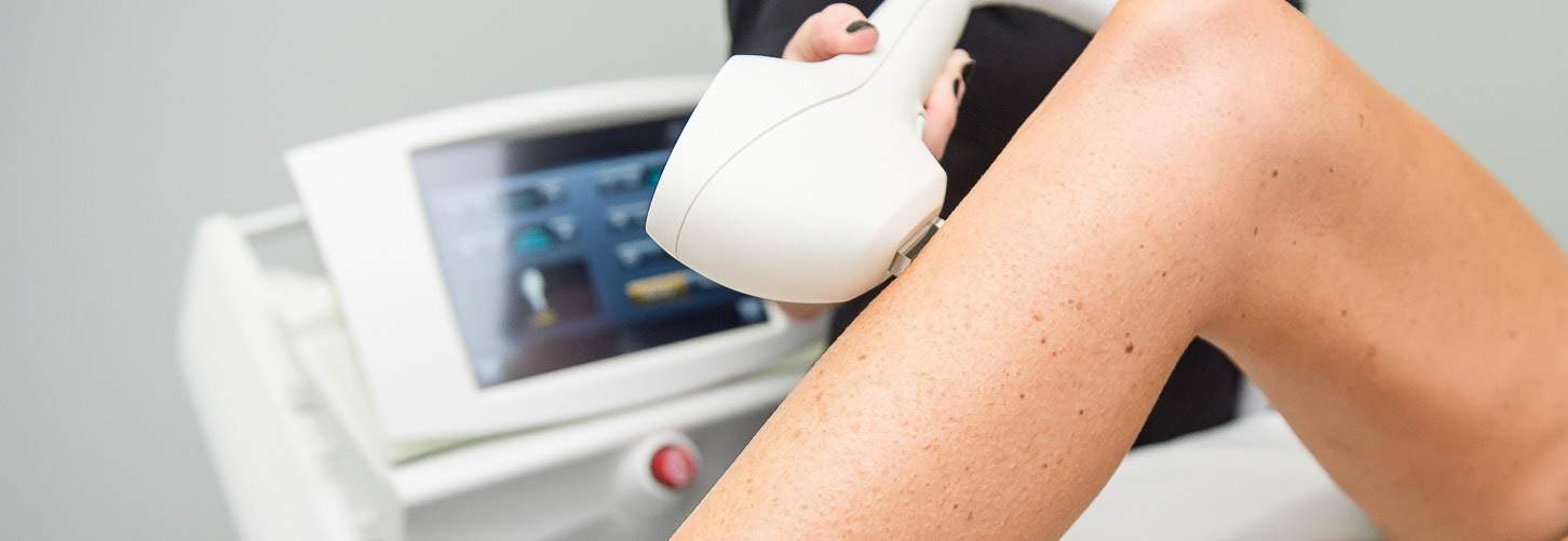 laser hair removal thornhill